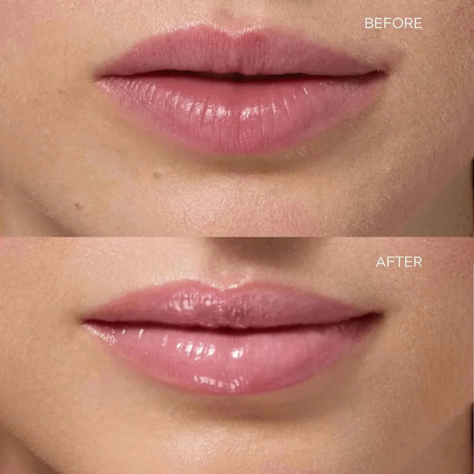 Prakti Beauty KhushiKiss™ - Luscious Lychee