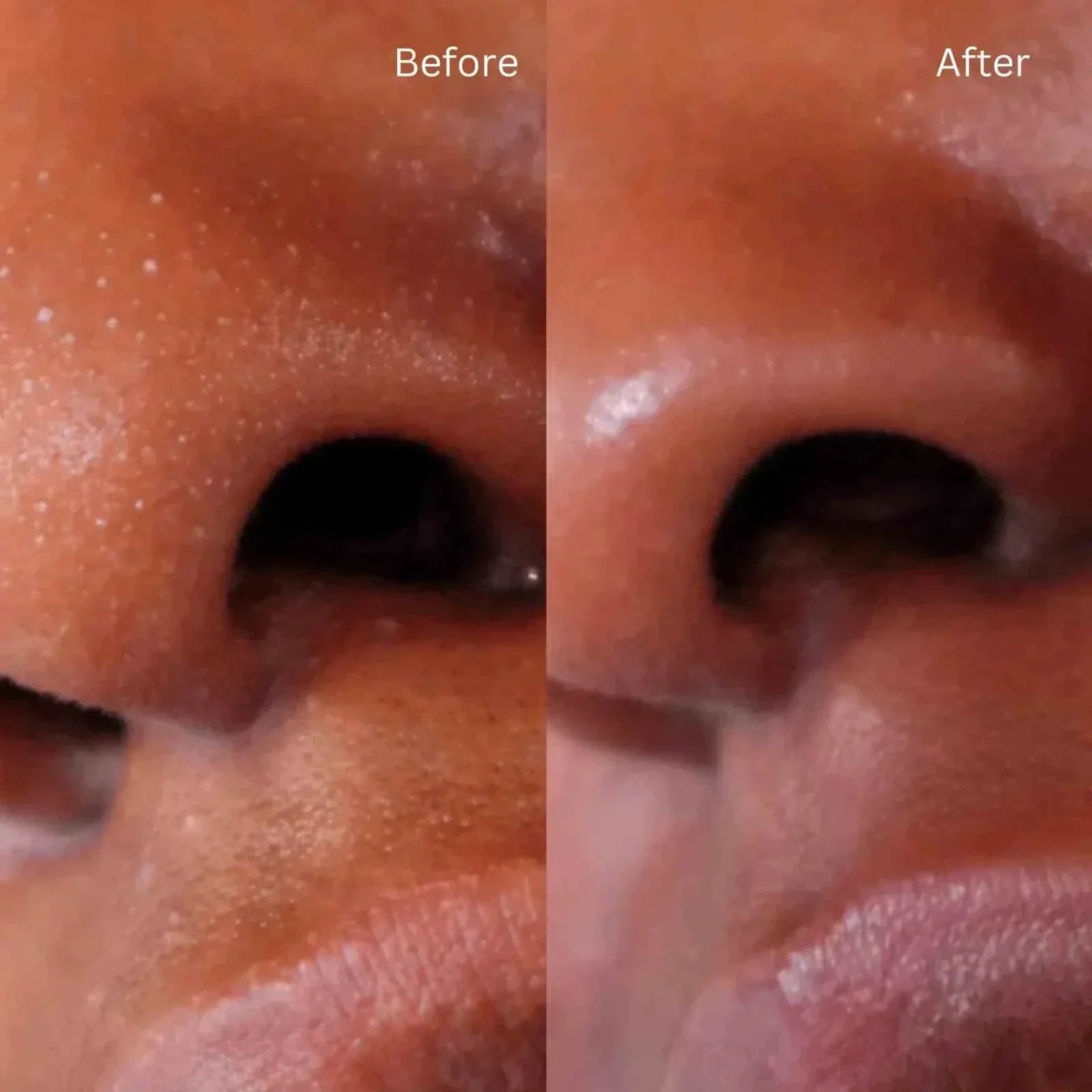 Before and after close-up of nose showing pore reduction using gentle facial exfoliator PritiPolish®